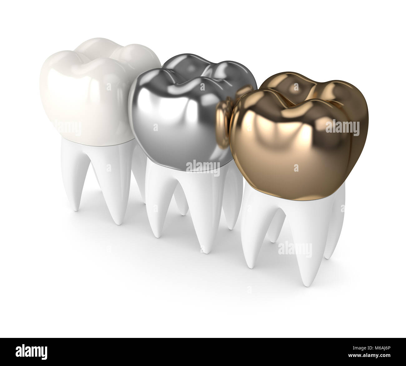 3D render de dents avec de l'or, des amalgames et composites dentaires couronne sur fond blanc Banque D'Images