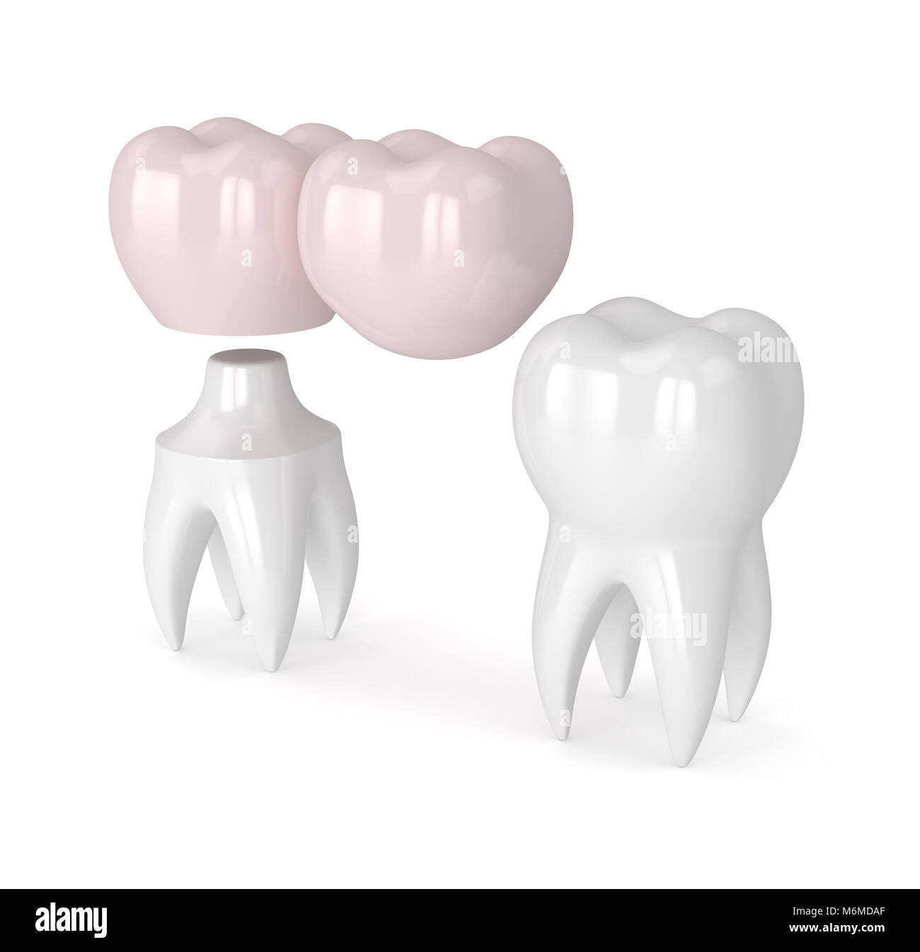 3D render de dents avec dental pont cantilever isolated over white background Banque D'Images