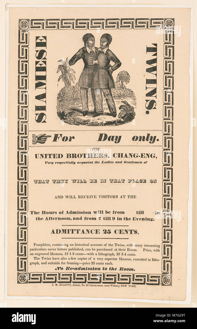 Cette photographie montre des jumeaux siamois, montrant leur condition physique unique. L'image capture un moment de l'histoire, reflétant les aspects médicaux et sociaux des jumeaux conjoints. Banque D'Images