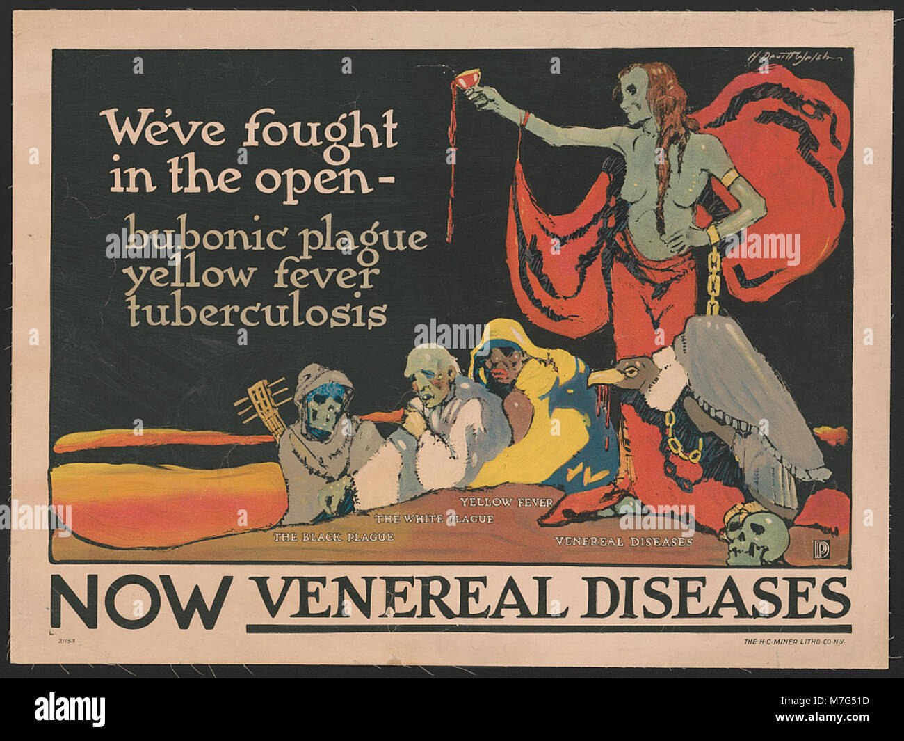 Cette image aborde les défis de santé publique rencontrés au début du XXe siècle, notamment la peste bubonique, la fièvre jaune, la tuberculose et la montée des maladies vénériennes. Il reflète les réponses médicales et sociétales à ces maladies infectieuses en période de crises sanitaires importantes. Banque D'Images