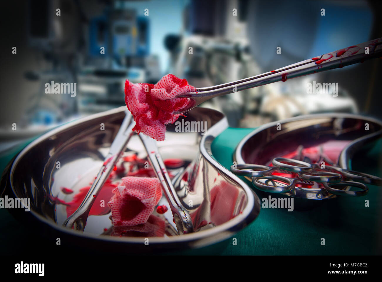 Montréal,Canada,10,mars 2018. Forceps Holding dans un hôpital de chirurgie.Crédit : Mario Beauregard/Alamy Live News Banque D'Images