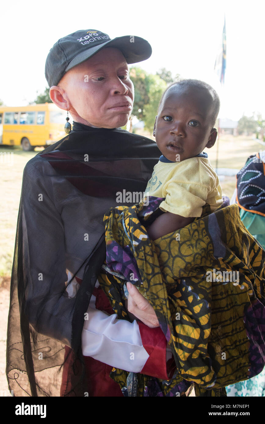 Une femme avec albinisme tient son bébé noir en Tanzanie Banque D'Images