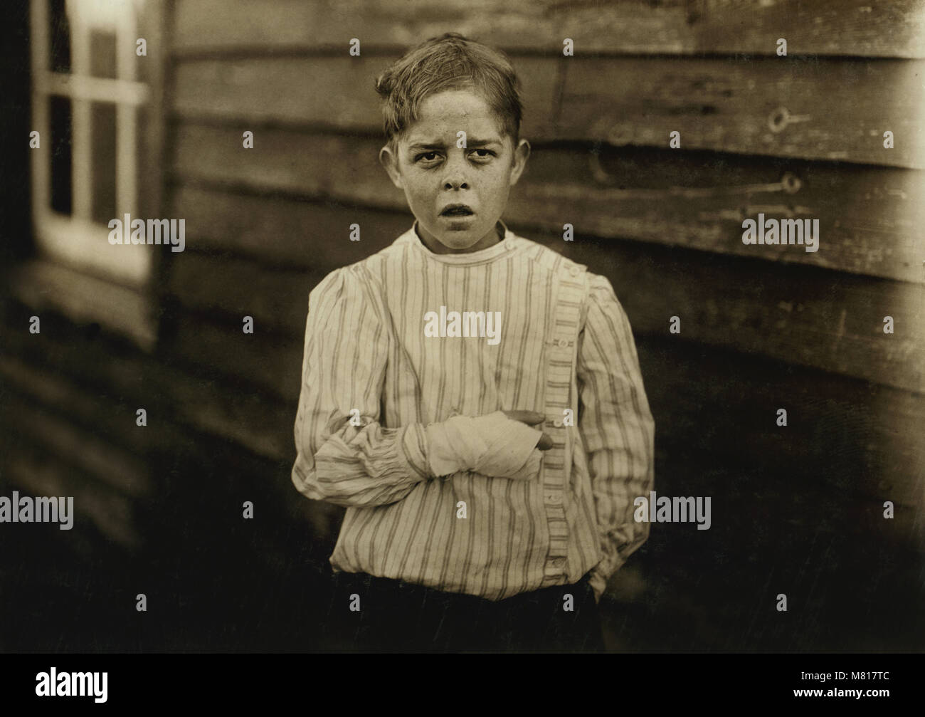 Giles Edmund Newsom, jeune travailleur dans une filature de coton, 12 ans, est tombée sur de machine à filer et sa main est allé à dans l'engrenage sans protection, perdre deux doigts, Half-length portrait Sanders, Filature, Bessemer City, North Carolina, USA, Lewis Hine pour Comité nationale sur le travail des enfants, Octobre 1912 Banque D'Images