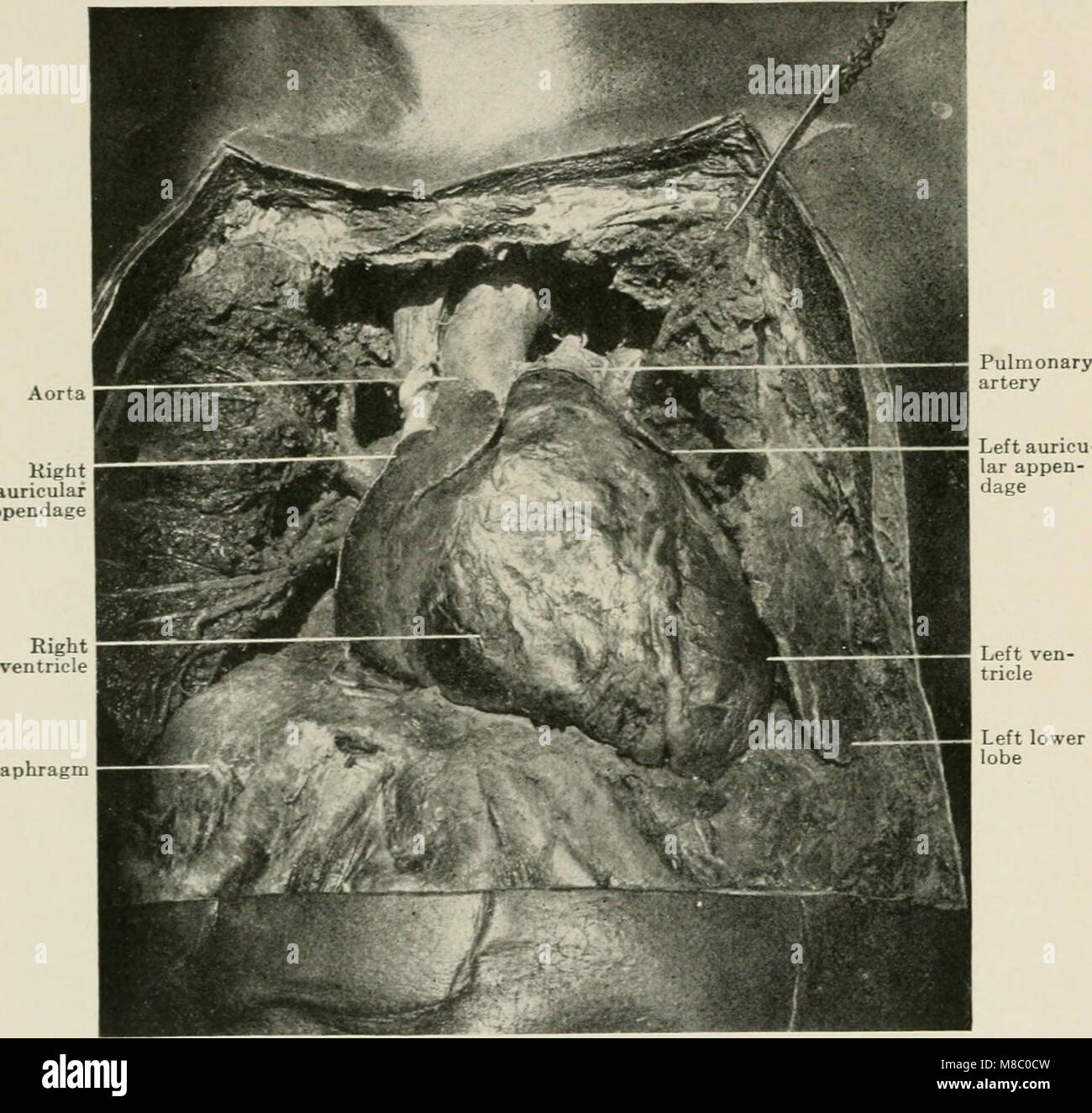 Les maladies de la poitrine et les principes de diagnostic physique (1920) (14799900833) Banque D'Images