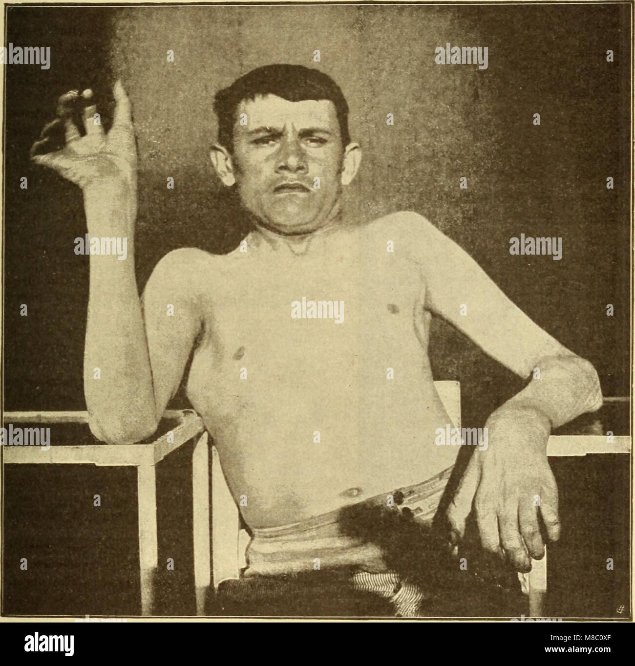 Cette publication de 1910 explore diverses maladies affectant le système nerveux, fournissant des descriptions cliniques, des symptômes et des informations sur les conditions neurologiques. Banque D'Images