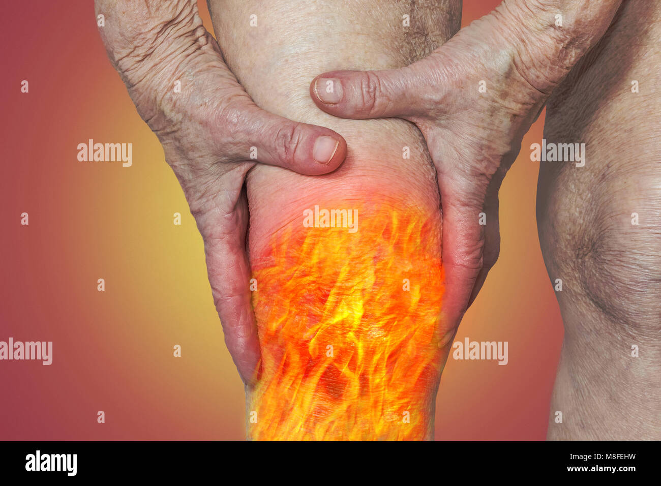 La femelle du genou et de la jambe douloureuse. Photo Concept Banque D'Images