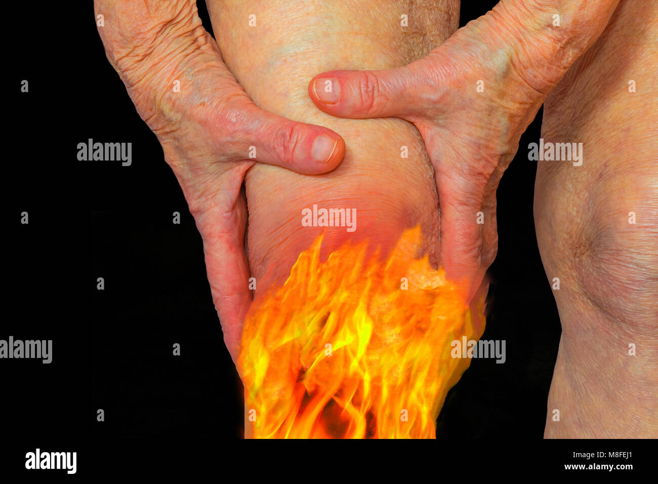 La femelle du genou et de la jambe douloureuse. Photo Concept Banque D'Images