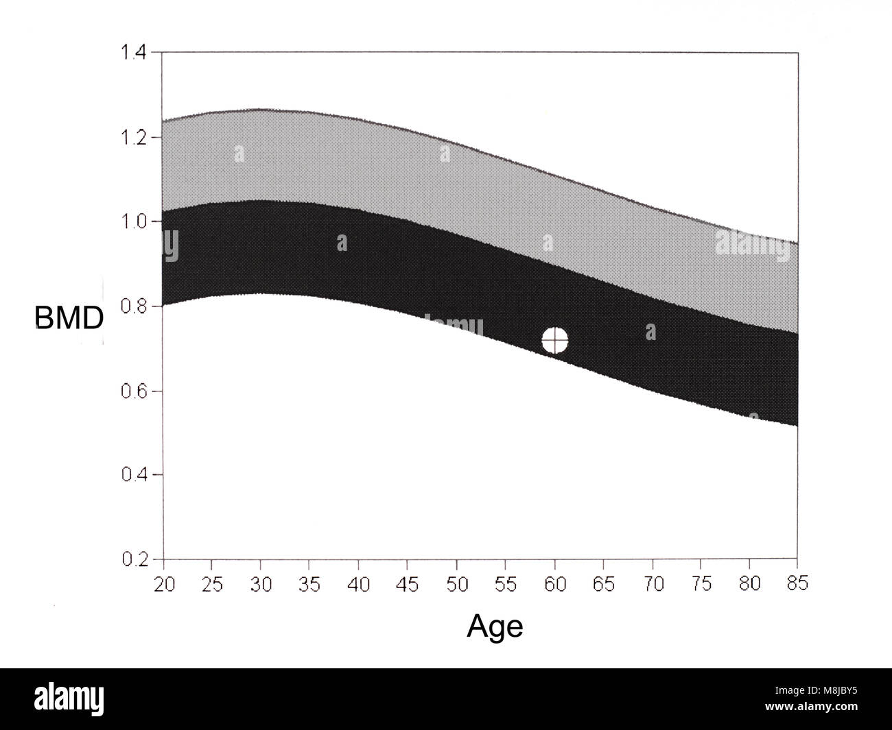 La densité osseuse de la DEXA scan. La technologie médicale, le diagnostic de l'ostéoporose. Banque D'Images