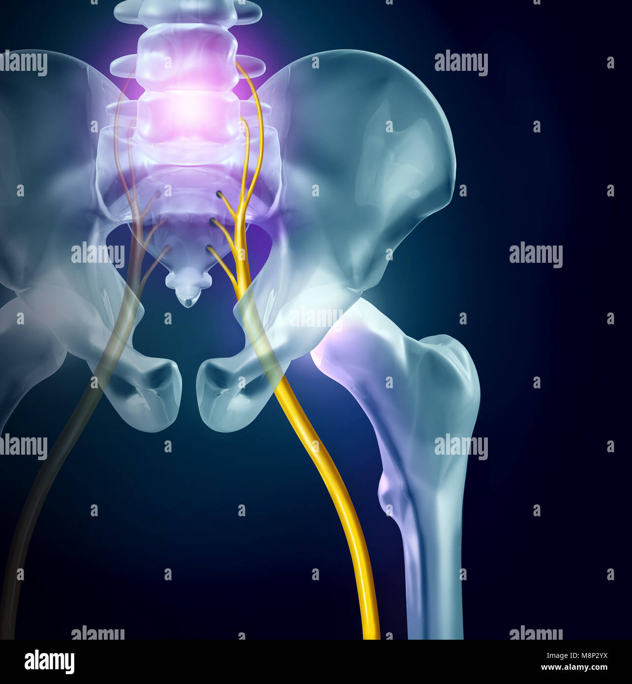 Symptômes et diagnostic douleur sciatique concept médical comme une maladie causant des problèmes physiques avec des éléments 3D illustration Banque D'Images
