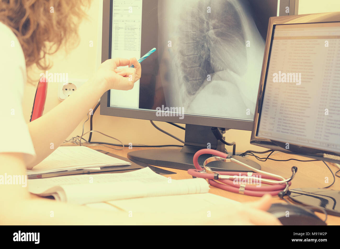 Le radiologue examine les x-ray images sur un écran d'ordinateur. Banque D'Images