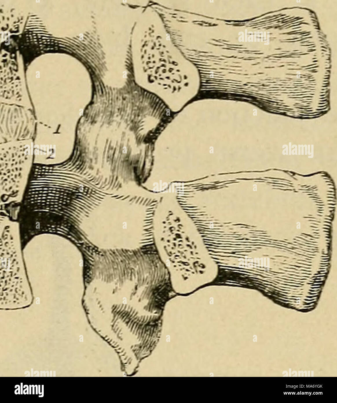 . Physiologie élémentaire . Fig. 7. de deux vertèbres lombaires montrant l'arrangement des disques intervertébraux. (R. Quain.) I, 2, la lame fibreuse ; 3, la substance douce centrale ; la capsule de l'articulation entre les processus articulaires des vertèbres est aussi indiquée. portent une ressemblance étroite homologie ou^ l'un à l'autre, et donc une description d'une vertèbre typique sera suffisante pour tous. La partie avant de chaque vertèbre est un cylindre court et plat, ou d'un disque, appelé le corps^ un peu plus petit dans son milieu que dans le haut ou le bas. À partir de la partie postérieure du corps l'arc neural Banque D'Images
