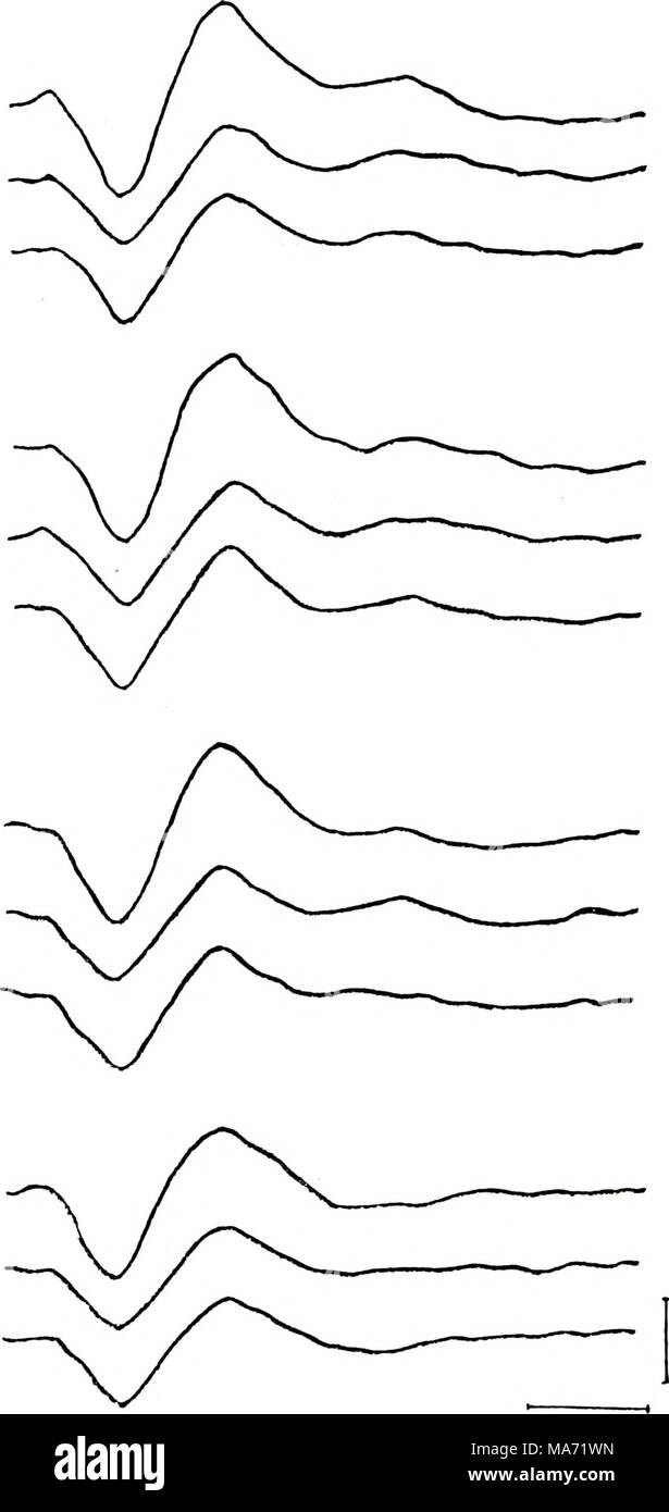 . Effets du traitement phonétique et sur la pertinence de stimulation de la réponse évoquée auditive. . 100 ms Figure 2. Potentiels évoqués en moyenne à T-^ inscrit relance de vertex (V), gauche (L) et droite (R), de l'articulation temporo-pariétal du site lors des diverses conditions. Chaque potentiel est une com- huit sujets de composites. Calibrage  = 10 microvolts. Banque D'Images