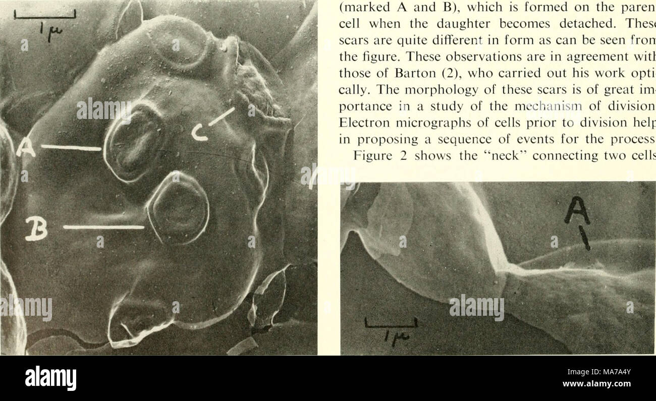 . La microscopie électronique ; actes de la Conférence de Stockholm, septembre 1956 . La grille a été immergée dans une solution de 3 g d'un mélange de bichromate de potassium permanganate et concen- tré dans l'acide sulfurique pendant quinze minutes. Après la dépose, il a été lavé dans l'eau, puis dans l'hydro- concentré acide chlorique pendant quelques secondes (cette opération a éliminé le dioxyde de manganèse formé par la décomposition de l'acide de mélange), et enfin dans l'eau. Après séchage, il était prêt pour l'examen et de l'alose- dus dans le microscope électronique. Il faut être prudent dans l'interprétation de les micrographies électroniques de re Banque D'Images