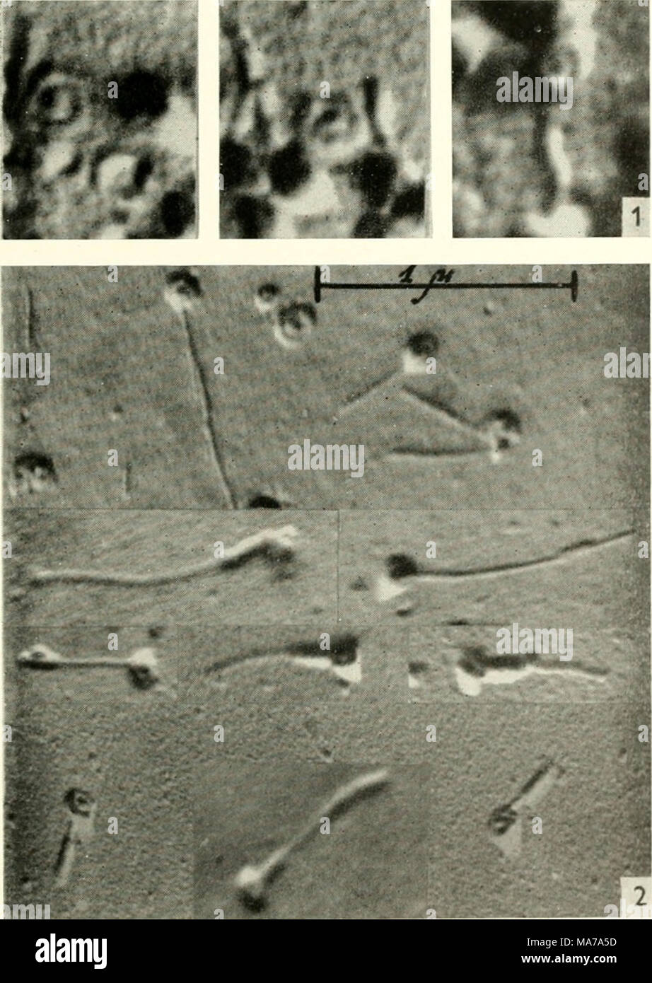. La microscopie électronique ; actes de la Conférence de Stockholm, septembre 1956 . Fig. I. forme en spirale de la tête des particules phagiques de BCU. mycoides. Fig. 2. Différents degrés de détorsion du filament qui forme une des particules phagiques Bcu. mycoides sous l'influence de la pression hydrostatique de 5000 atm. pendant 2, 4, 20 et 48 heures. Ces structures filamenteuses sont trouvés dès les premières étapes de la formation de particules phagiques (4, 8). Cela peut être vu par exemple lors de l'étude directement sur la grille de lyse recouvert d'un film parlodion selon une méthode par Pocotinsky et autres (9) et m Banque D'Images