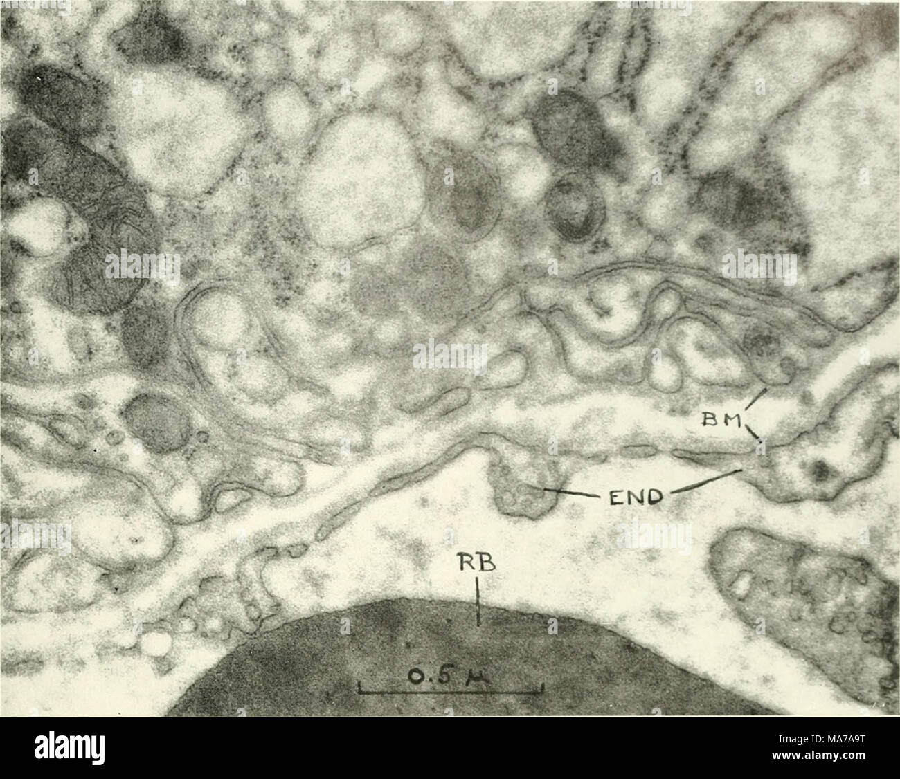 . La microscopie électronique ; actes de la Conférence de Stockholm, septembre 1956 . Fig. 2. Section à travers la partie basale d'une cellule de la thyroïde et d'un capillaire montrant des discontinuités de l'endothélium. BM  = base- ment membrane : FIN -Â ^- : l'endothélium RB -- red blood corpuscule. 62 Agrandissement,C00. plus ou moins distinctes et la membrane assez dense de la membrane basale de l'endothélium continue uninter- vée sur ces domaines. La largeur de la discon- tinuities est d'environ 300 A. Références 1. Braunsteiner, H., Fellinger, K., et Pakesch, F., Endocrinologie 53, 123 (1953). 2. Dempsey, E. W. et Pi n personne, R. R., Banque D'Images