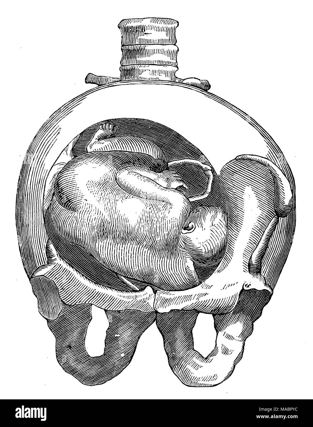 Emplacement d'un enfant dans l'utérus : position de l'épaule Banque D'Images