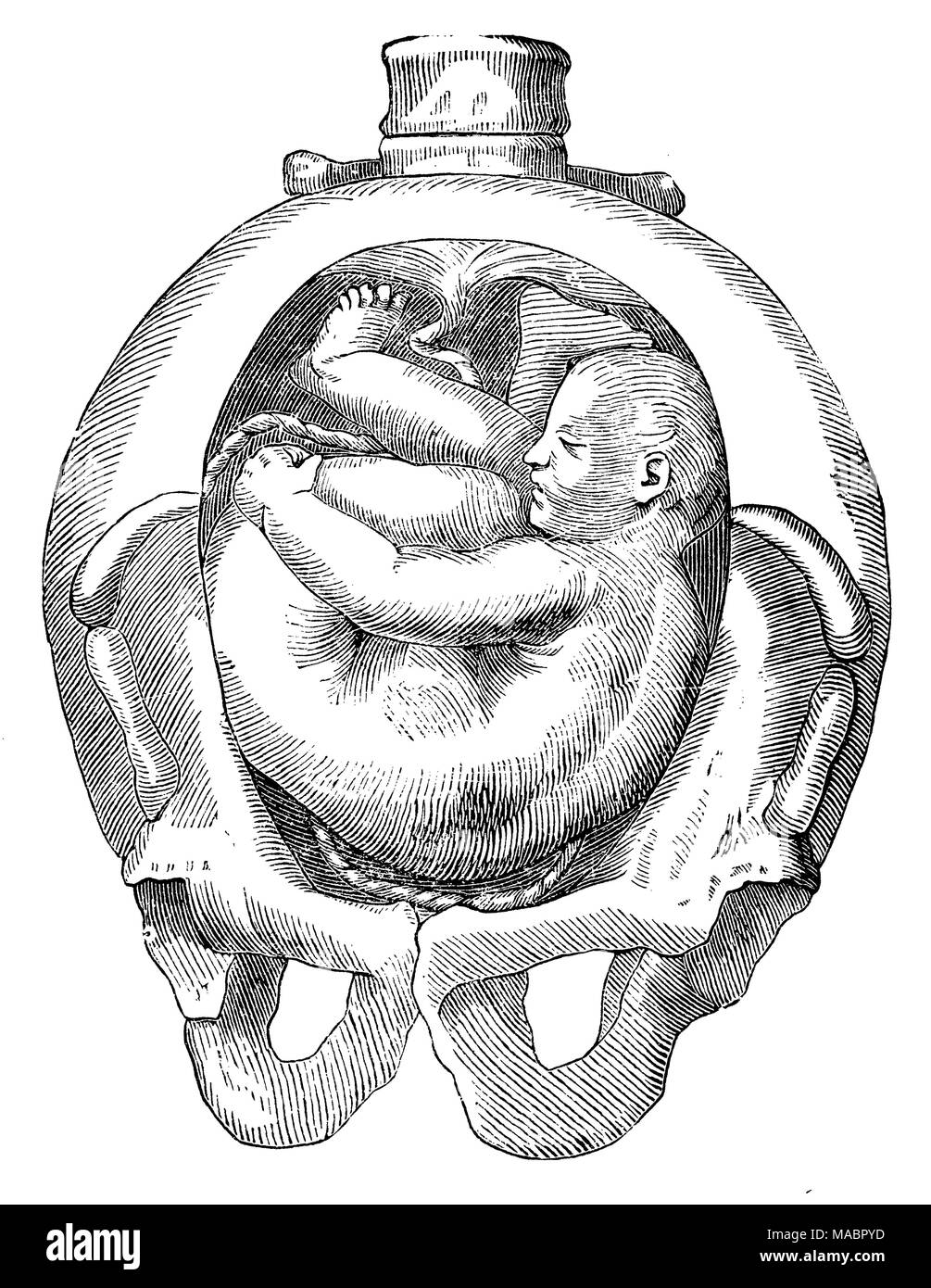 Position d'un enfant dans l'utérus : position dorsale Banque D'Images