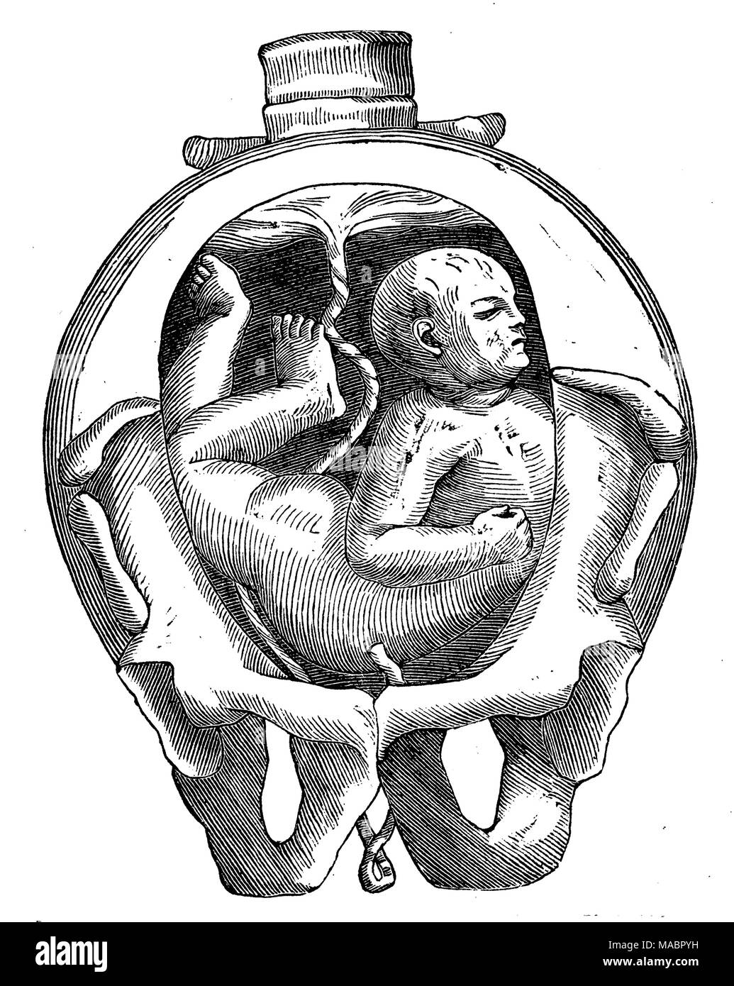 Position D Un Enfant Dans L Uterus Couche Avec Le Prolapsus Du Cordon Ombilical Photo Stock Alamy Position D Un Enfant Dans L Uterus Couche Avec Le Prolapsus Du Cordon Ombilical Photo Stock Alamy