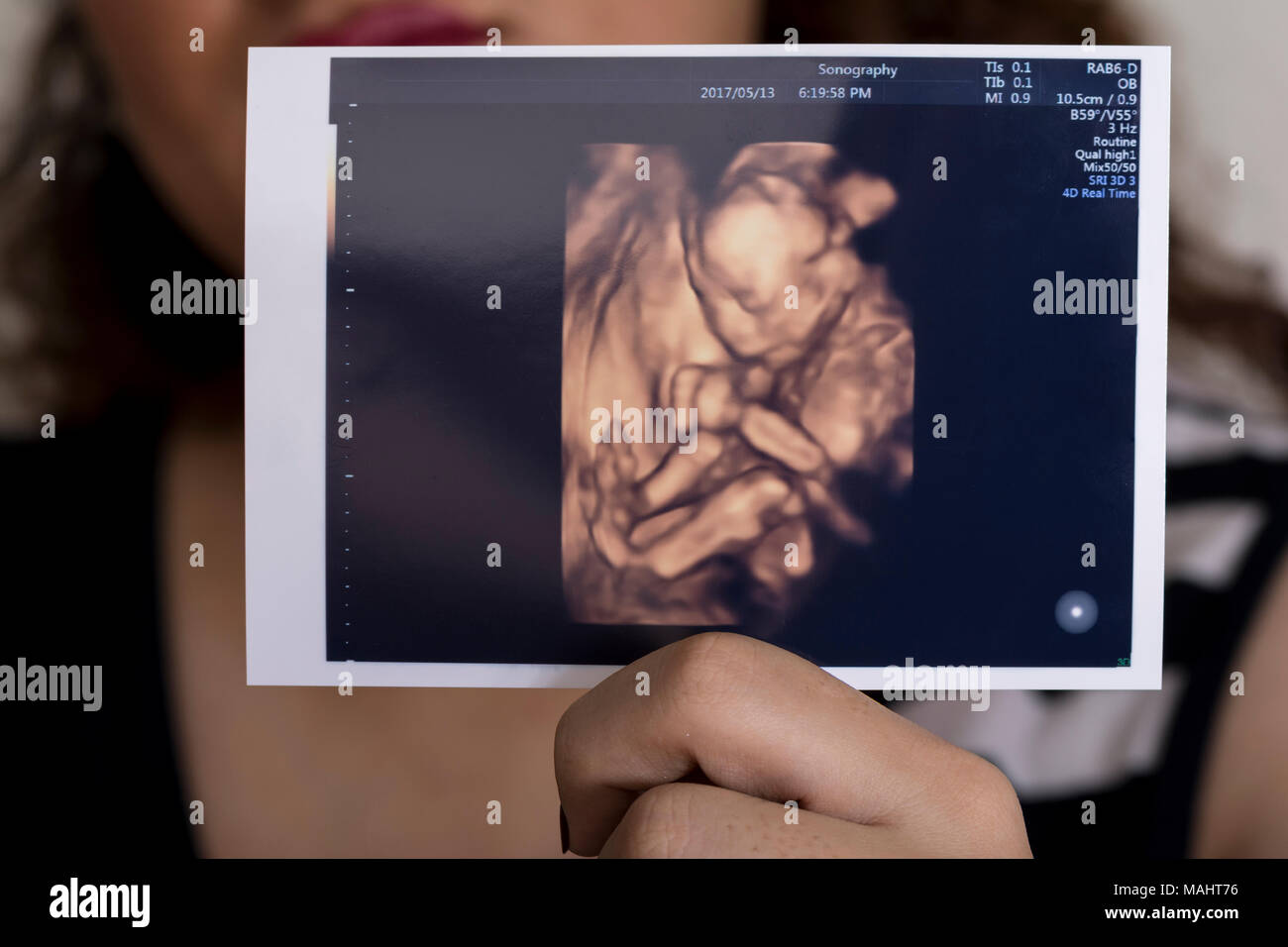 Human Fetus Banque D Image Et Photos Page 5 Alamy