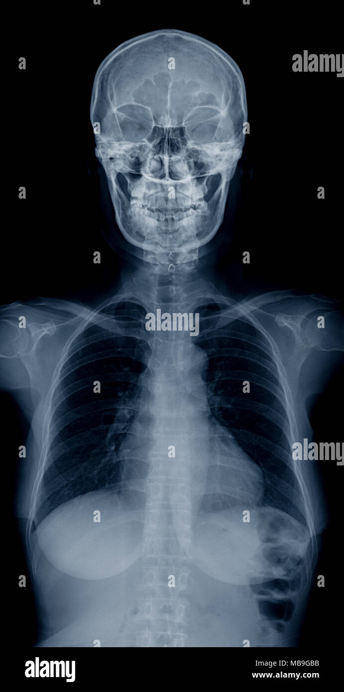 Anatomie du haut du corps masculin Banque de photographies et d’images