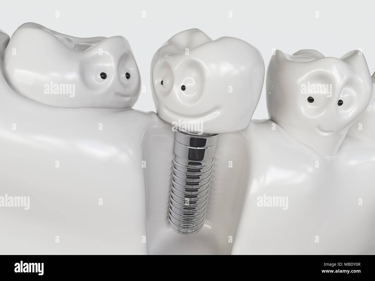 Des dents implant cartoon - le rendu 3D Banque D'Images