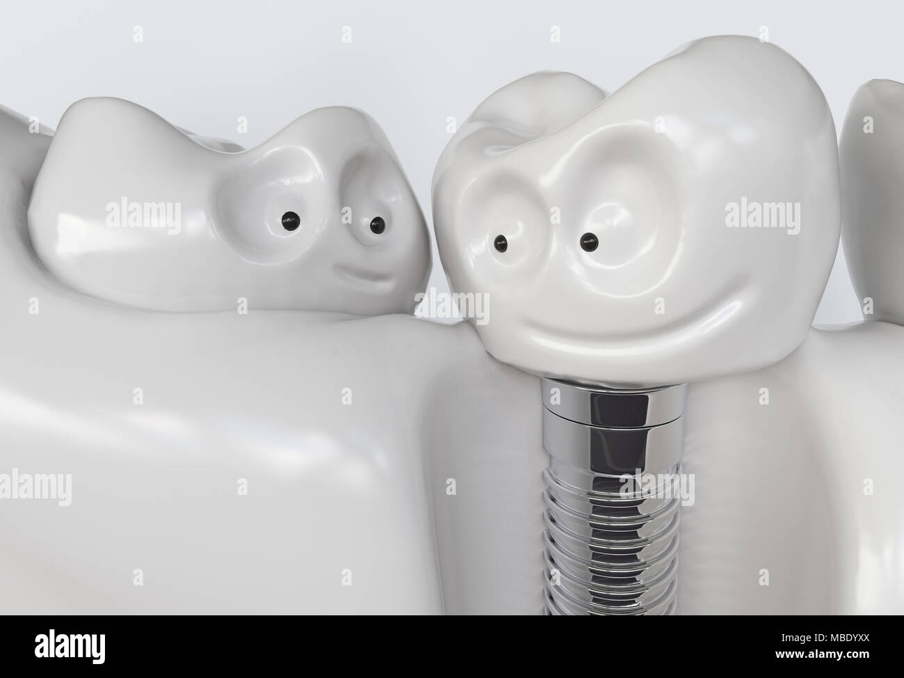 Des dents implant cartoon - le rendu 3D Banque D'Images