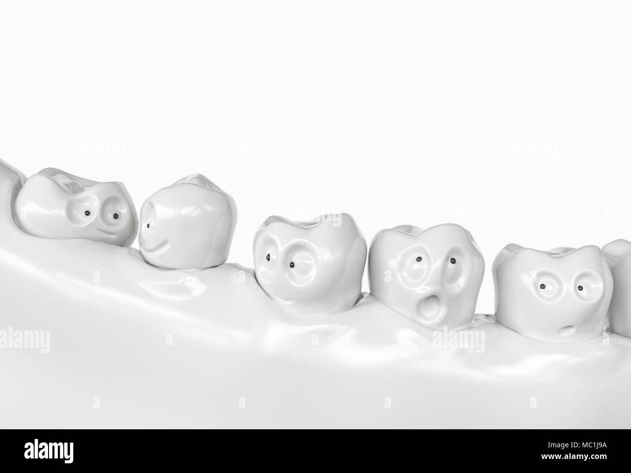 Des dents implant cartoon - le rendu 3D Banque D'Images