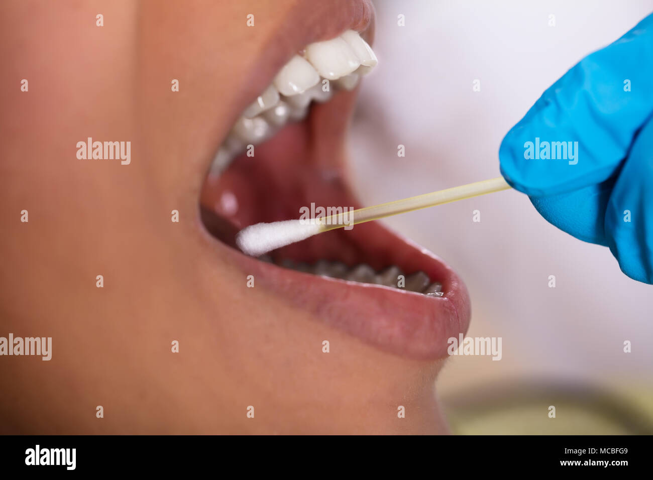 Close-up of a Dentist's part faire de test de salive sur la bouche avec du coton-tige Banque D'Images