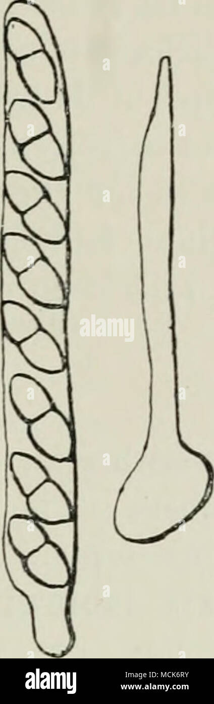 . Fig. 96.-Gibbera vaccinii. Asctis avec huit spores isolées ; cheveux isolés de l'extérieur d'un périthèce. (V. Tubeuf del.) Fig. 95.-Gibbera vaccinii sur l'airelle rouge. La forme des périthèces taches noires sur les feuilles, direction générale de la vie ainsi que les morts l'un Jarown. (V. Tubeuf del.) Fig. 97.-Gibbera vaccinii. Échantillon d'airelle rouge montrant un patch de périthèces dans la section ; les périthèces contiennent des paraphyses et velues avec des spores des asques ; un mycélium pénètre le tissu cortical de l'hôte. Peu de poils crochus couvrir l'épiderme de la tige. (V. Tubeuf del.) des périthèces sphériques, qui sont enduits Banque D'Images