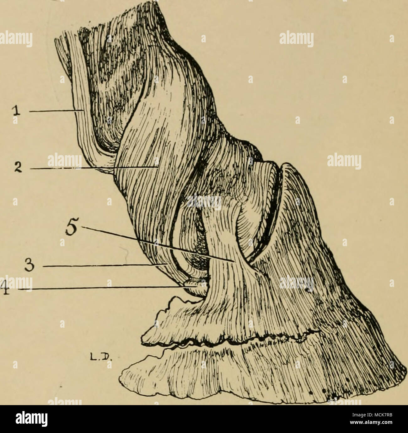 . Fig. 8.-des ligaments de la première et deuxième articulations interphalangiennes (vu de côté). (Après le dollar et Wheatley.) 1, ultrapériphériques de l'glenoidal fibro-cartilage, ligament latéral ; 2 de la première articulation interphalangienne ; 3, de l'allongement de la première du ligament latéral de l'articulation interphalangienne attaché à la fin de l'os naviculaire pour former le postero-latéral du ligament commun pédale ; 4, fin de l'os naviculaire ; 5, ligament antéro-latérale de la pédale. mixte s'attache à peu près au milieu du bord latéral de l'suffraginis, et les autres Banque D'Images