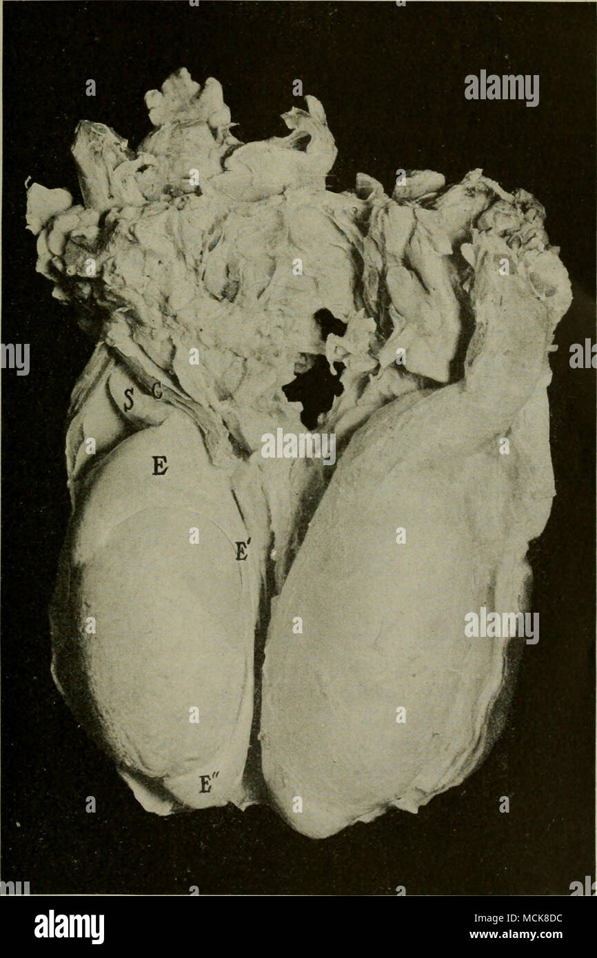 . Fig. 2-testicules de Bull. Section à travers la paroi postérieure du taureau du scrotum. Le testicule gauche est complètement exposé, la droite est couverte par le muscle crémaster et fascia et par le péritoine du scrotum. C, muscle crémaster divisé longitudinalement ; S, sper- matic épinière ; E, chef de l'épididyme ; E', E" ; Idem, Idem de queue. Banque D'Images
