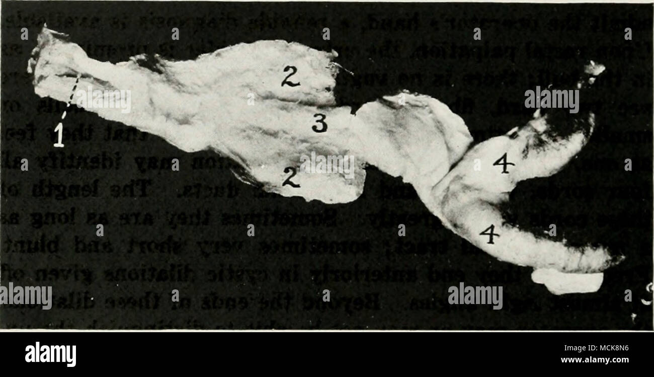 Fig 50 Meme Comme Fig 48 49 Uriuarius Meatus 2 J Wolttian J Muellerian Gaines Gaines