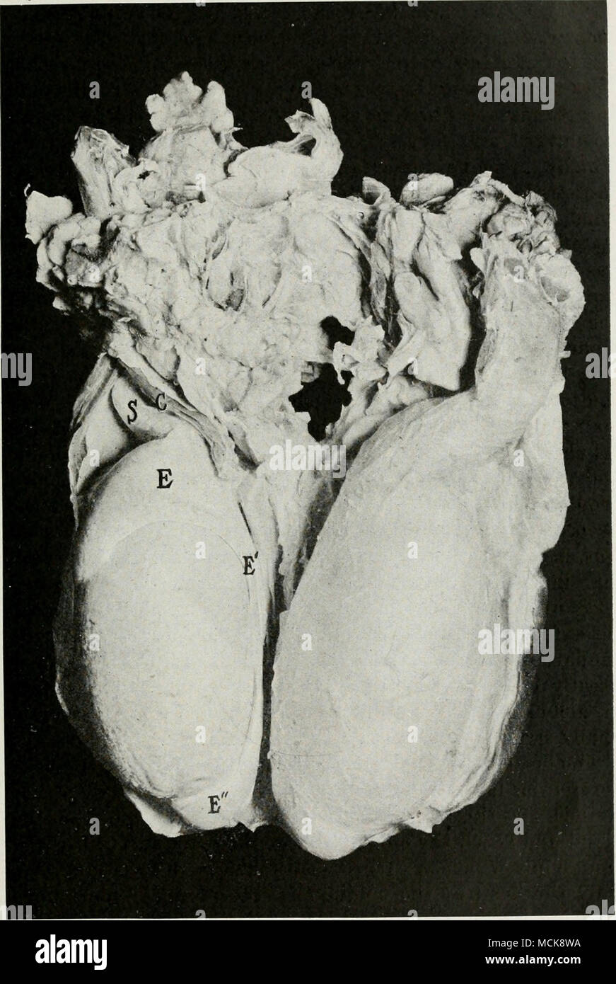 . Fig. 2-testicules de Bull. Section à travers la paroi postérieure du taureau du scrotum. Le testicule gauche est complètement exposé, le droit est couvert par le creuiaster tascia et musculaire et par le péritoine du scrotum. C muscle crémaster divisé longitudinalement ; .S, sper- matic épinière ; E, chef de l'epididvniis ; E', E" ; Idem, Idem de queue. Banque D'Images