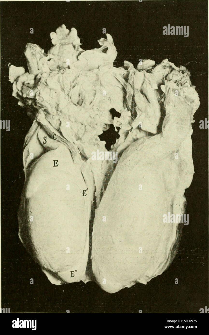 . Fig. 2-testicules de Bull. Section à travers la paroi postérieure du taureau du scrotum. Le testicule gauche est complètement exposé, la droite est couverte par le muscle crémaster et fascia et par le péritoine du scrotum-. C, muscle crémaster divisé longitudinalement ; S, sper- matic épinière ; E, chef de l'épididyme ; E'', idem ; E", queue idem. Banque D'Images