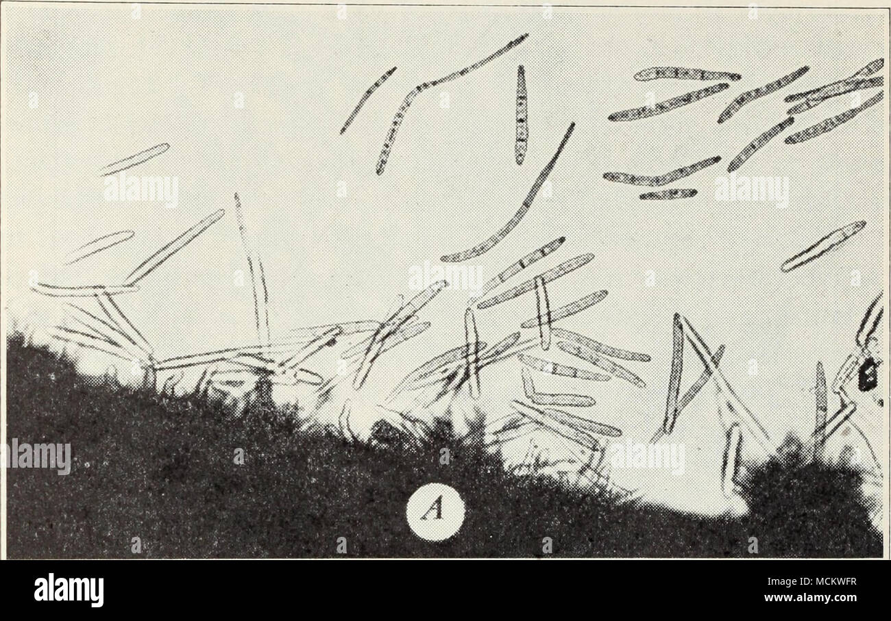 . • ..^§ BmiS jg|j'• »^ V JFL "^1 J ) k JSk JH ^^B 1 J si Fig, 12.-spores de champignons carotte-bactérien : A, B ; les spores de Cercospora, Macrosporium les spores. (Considérablement agrandi.), une partie des zones irrégulières apparaissent sur les feuilles, les lignes brun foncé sur le peti- le bace et tiges, et une brûlure sur les organes floraux. Parfois, ce bac- terial infection, causée par Phytonionas carotæ, est limité à un côté Banque D'Images