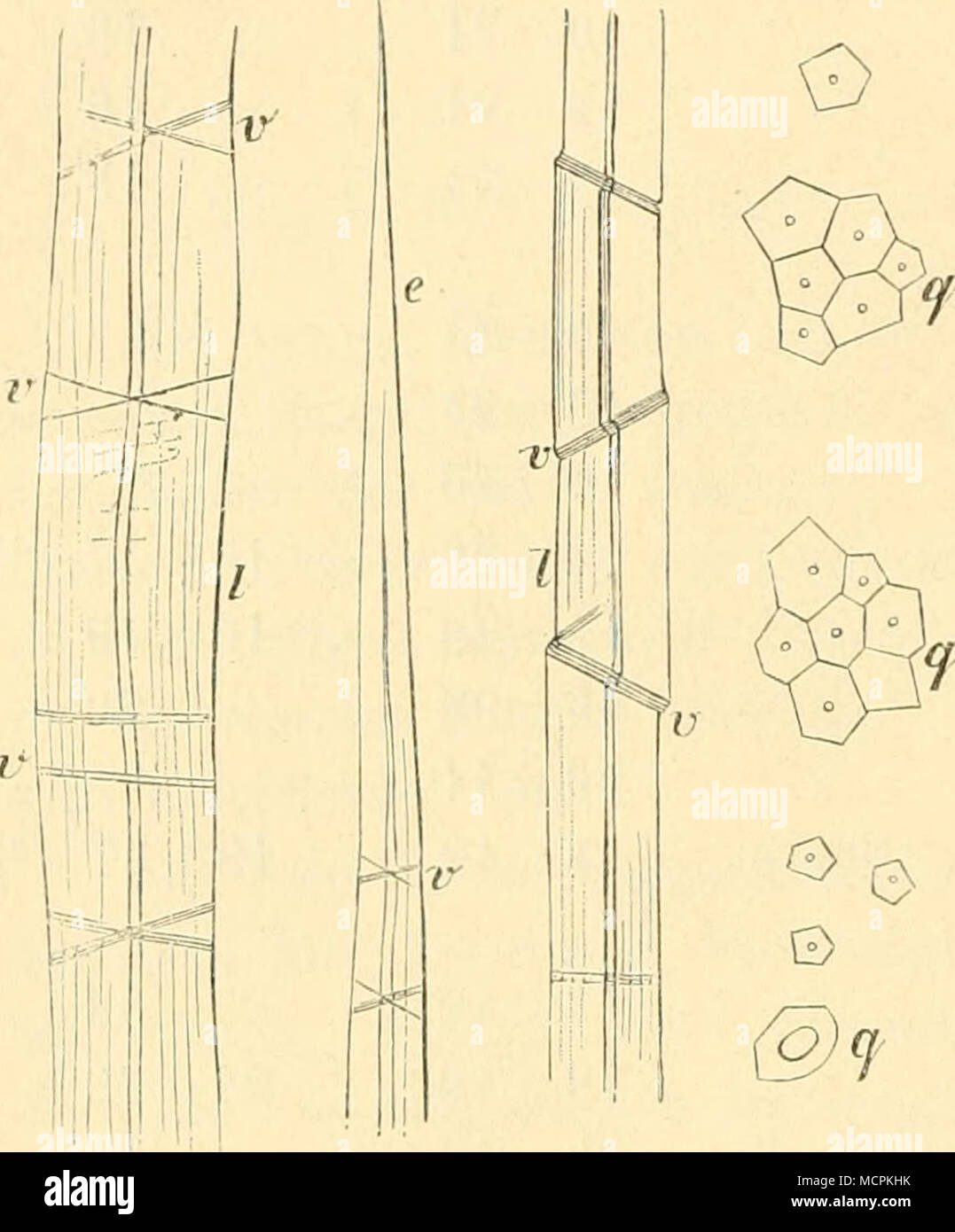. Fig. 52. Vergr. 400 1iez. Querschnitte (ij) 200. Flachs faser, e Spitze, Verschiebungen "vv", in der Längs ansieht l gesehen. Nach v. Hühnel. seifigen tretend Verbände, kei- nerlei mechanische Angriffe erleiden. Solche Weise auf die frei von isolirten Fasern" Verschiebungen "gefunden. Guerre dem genannten Autor es nur darum, zu entscheiden zu thun, ob die Pflanze durch ihre eigene dazu. Thätigkeit beitrage, ihre mechanischen Elé- mente zu schädigen. Leinenfaser auf und andere technisch verwendeten Fasern, welche die Erscheinung Verschiebungen darbieten "der", ist Ich habe von Leinenfasern Banque D'Images