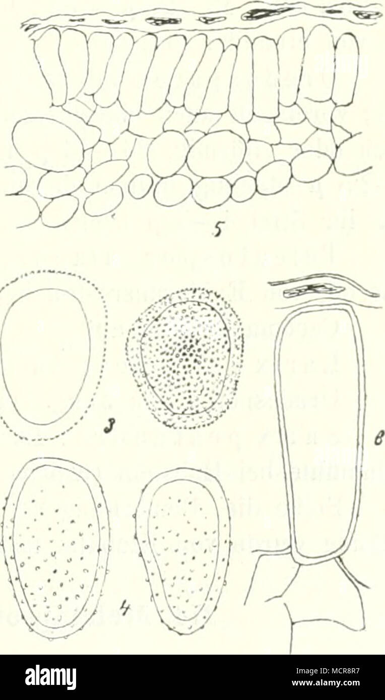 . Abb. 49. Melampsora Ayni/ dnli, ;&gt;ia&Lt ; : 1. Spermogonien- Claeo ma und auf Salix amygda- Lina. Â ¢ '. J'Letten von C/ieomasporen, para-¶vergrÃ sserte und lysen Sporen. 3. ¶VergrÃ Caeomasporen sserte Stark. 4. Uredospo- ren. 5. Schnitt durch ein Teleutosporen- lager. (5. Eine Partie deÃ 2004-2005 selben stark ver-¶sseit giÃ. Klebabn^ (nach. Banque D'Images