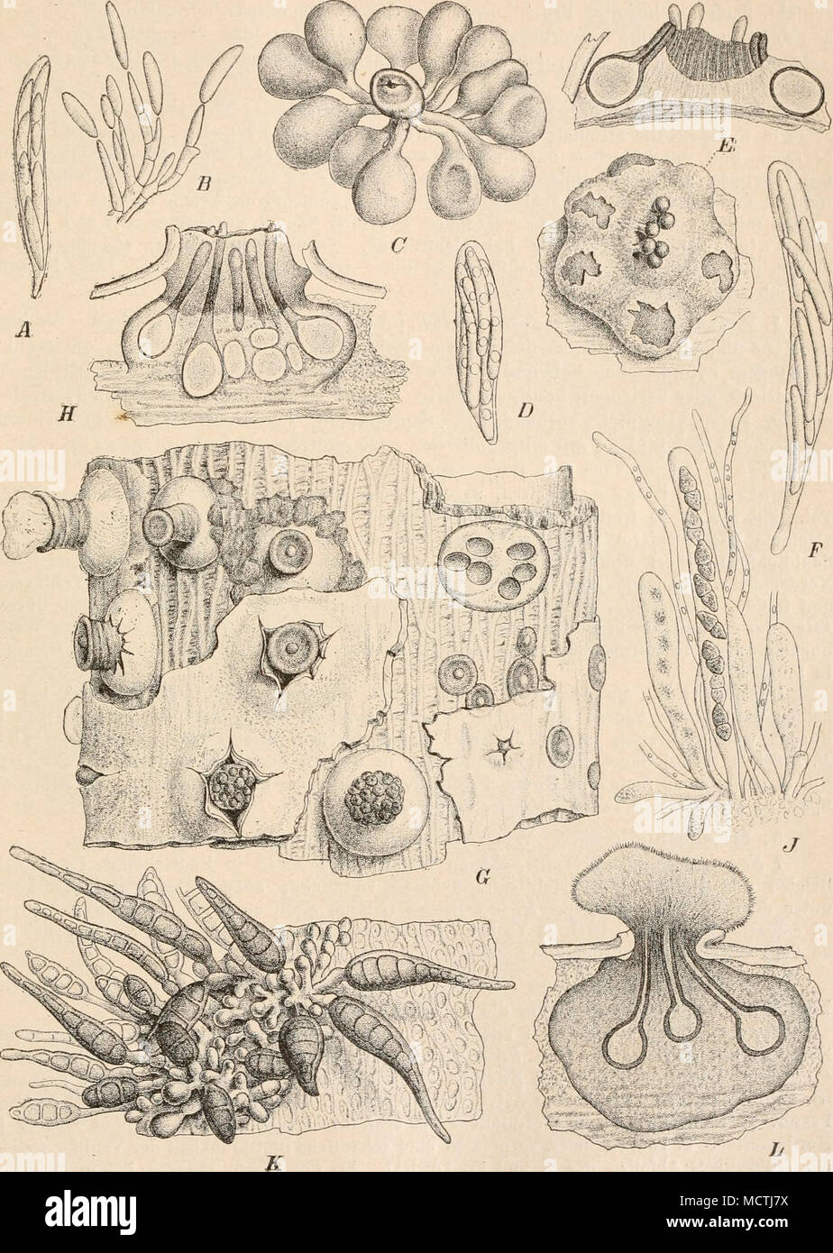 . Fig. 279. Un hypodermia Cryptosporella, B (Fr,) Sacc. Un Schlaucli (200|1) ; B Stück vom hyménium der Pyknide (300/1). CD - Cryptospora suffusa (Fr.) Tul. C Perithecienbüschel eines Stromas (20/1) ; D Schlauch (380|1). - E, F C. betulae TNL. E von oben und im Stroma Längsschnitt (20/1) ; F Schlauch (380/1). - 0L Valsaria Tiliae (Pers.) de Not. G l'habitus (10(1) ; H im Längsschnitt Stroma (20/1) ; J Schläuche (3S0|1) ; A' Stück des lagers Conidien- (3S0|1) ; L Stroma mit dem Conidienlager im Längsschnitt (30|1). {A, B nach Brefeld ;. das übrige nach Tulasn e.) Banque D'Images