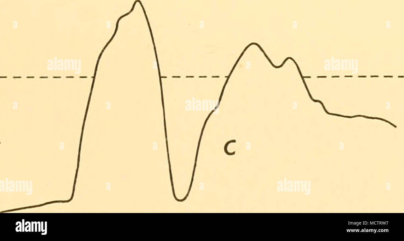 . 1 II I I I I I I I I I I 1 I I I I I I I I I I I I I I I I M Fig. 2. a. La section du nord-est au sud-ouest entre la Géorgie du Sud et Sandwich du Sud Groupe : basé sur 18 sondages réalisés entre 55" 05' S, 32° 26' O et 56° 01' S, 34° 13' O. h. La section du nord au sud entre les îlots Shag et la Géorgie du Sud : Sur la base de sondages effectués entre 53 8^ 13' S, 39° 53' O et 54° 10' S, 40° 02' O. c. La section du nord au sud entre les Orcades du Sud et de l'Île Clarence : basé sur 43 sondages réalisés entre 59° 49' S, 49° 24' O et 61° ooJ' S, 49° 48' O. échelle verticale de tous les trois sect Banque D'Images