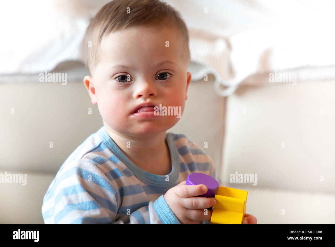 Trisomie 18 Banque de photographies et d’images à haute résolution Alamy