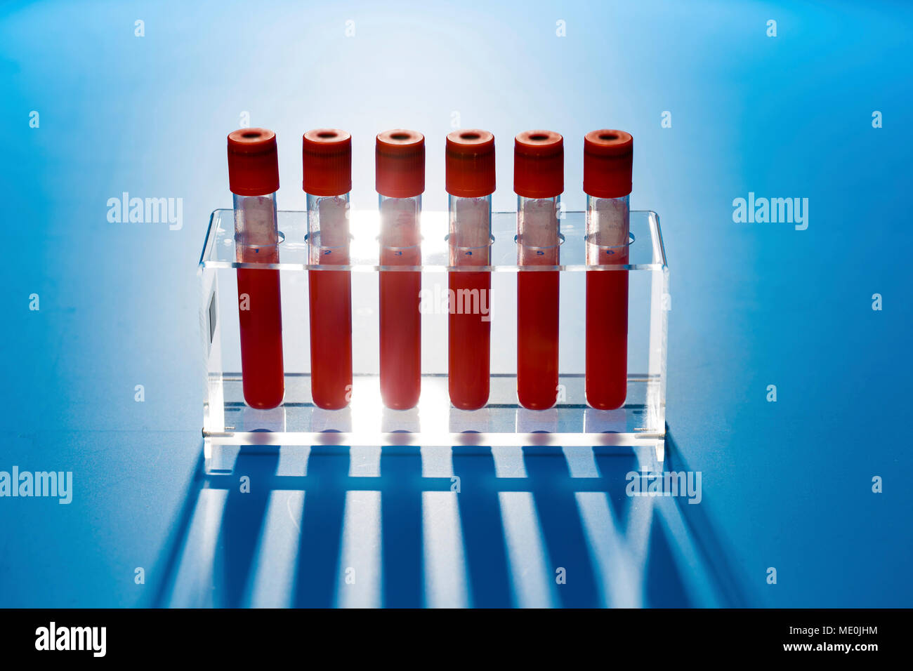 Des échantillons de sang dans un laboratoire. Banque D'Images