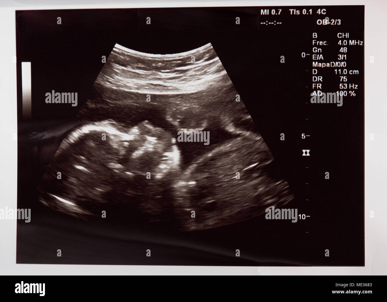 Tete De Bebe Sur L Echographie A L Hopital Verifier Photo Stock Alamy Tete De Bebe Sur L Echographie A L Hopital Verifier Photo Stock Alamy