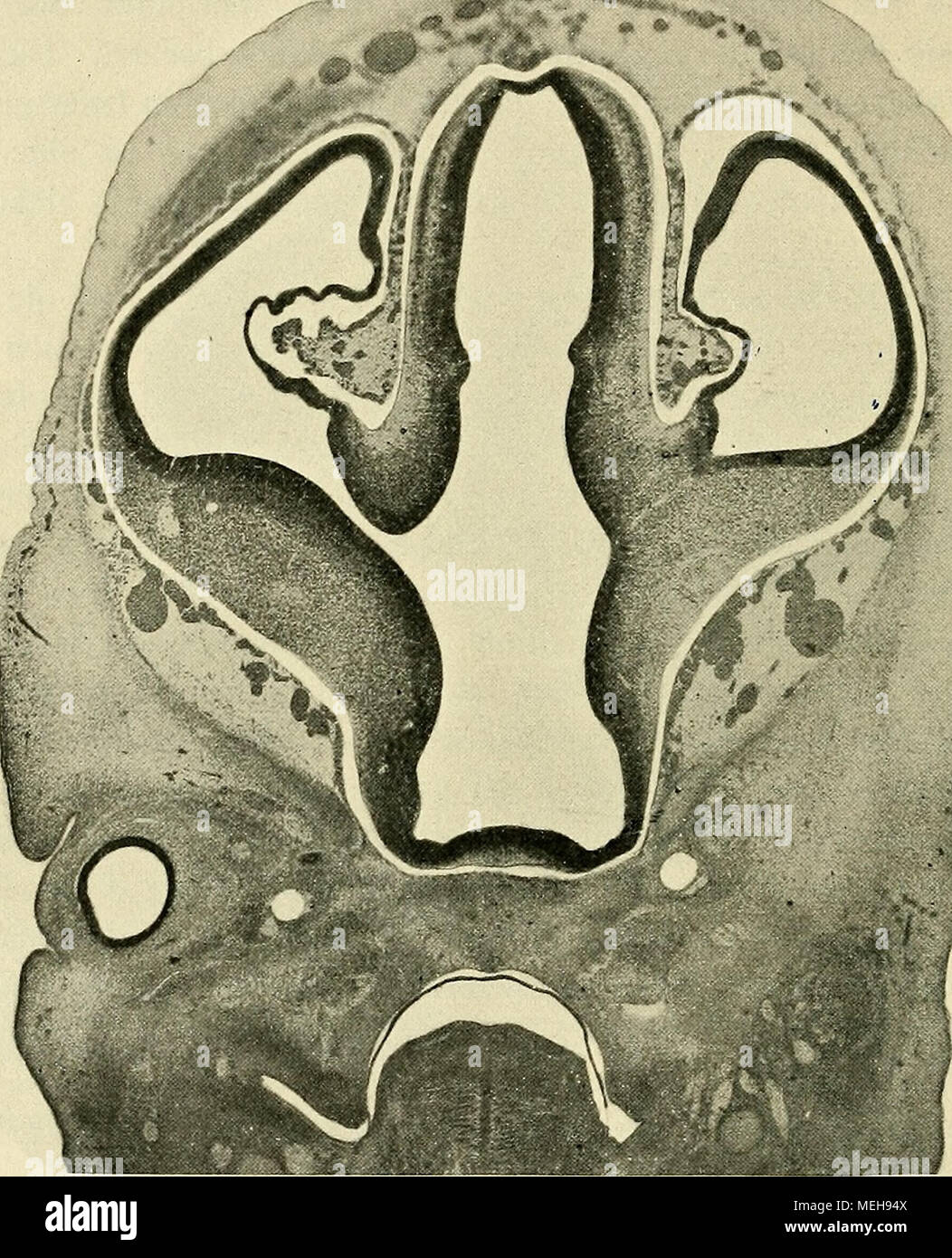 . Die Entwickelung des menschlichen Gehirns : während der ersten Monate : Untersuchungsergebnisse . Fig. 83. Durcli Vorderhirii Querschnitt das von embryon Se (Nl. 16 mm). Streifenliügol liens thalamus und sind getrennt, rechts beginnt die Verbindung beider. An der medialen Hemisij hären wand öffnet sich mit- sehr weitem die die Fissura chorioidea, dans die eine 41 Gefäßschicht eintritt iZu Seite 123..) Sagittalschnitten besprochenen des oben Wi embryon, ist die zu dem chorioideus xlrterie Plexus führende als ein aus der carotis interna empor- steigendes Stämmchen nachweisbar. Der Blutabf Banque D'Images