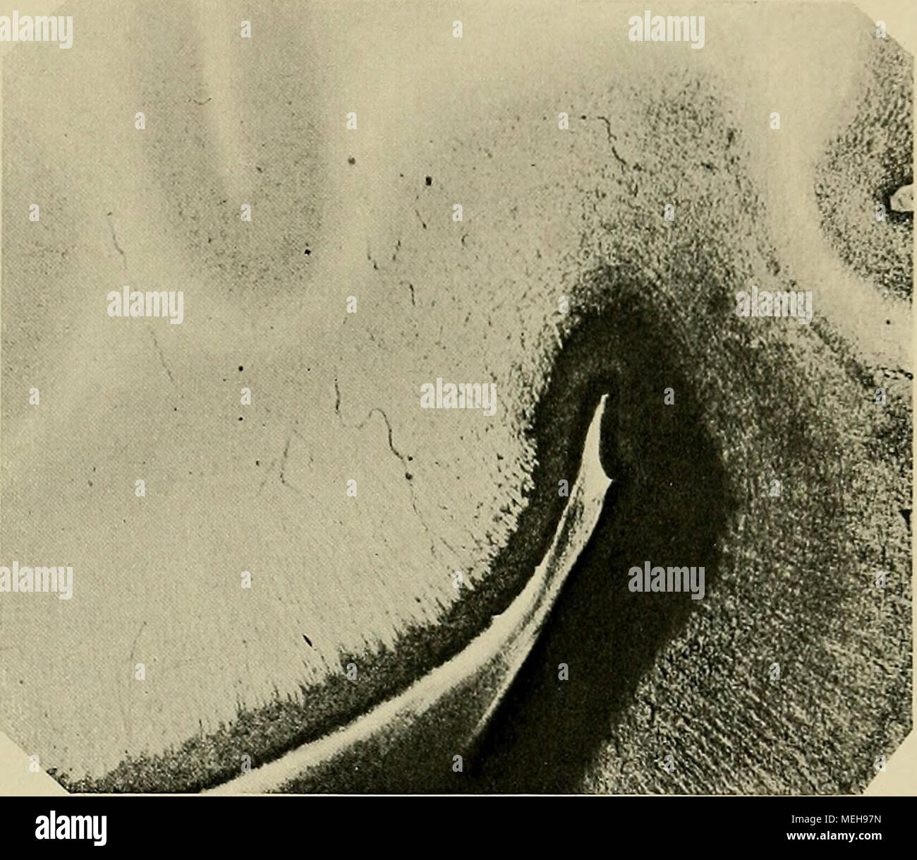 . Die Entwickelung des menschlichen Gehirns : während der ersten Monate : Untersuchungsergebnisse . Fig. 76. Ventrilsuläre Hemispliärenwand von der Oberfläche foetus PI. Der Schnitt zeigt die noch von Höhlengran ziemlich Schicht dicke und die von dieser nach auswärts ausstrahlenden zellenreichen 160 Kellnertasche dunkeln (). Zwischen den letzteren liegen die Markfasern blattartiger à disposition, die den Pvramidenzellen entstammen Einde der. Banque D'Images