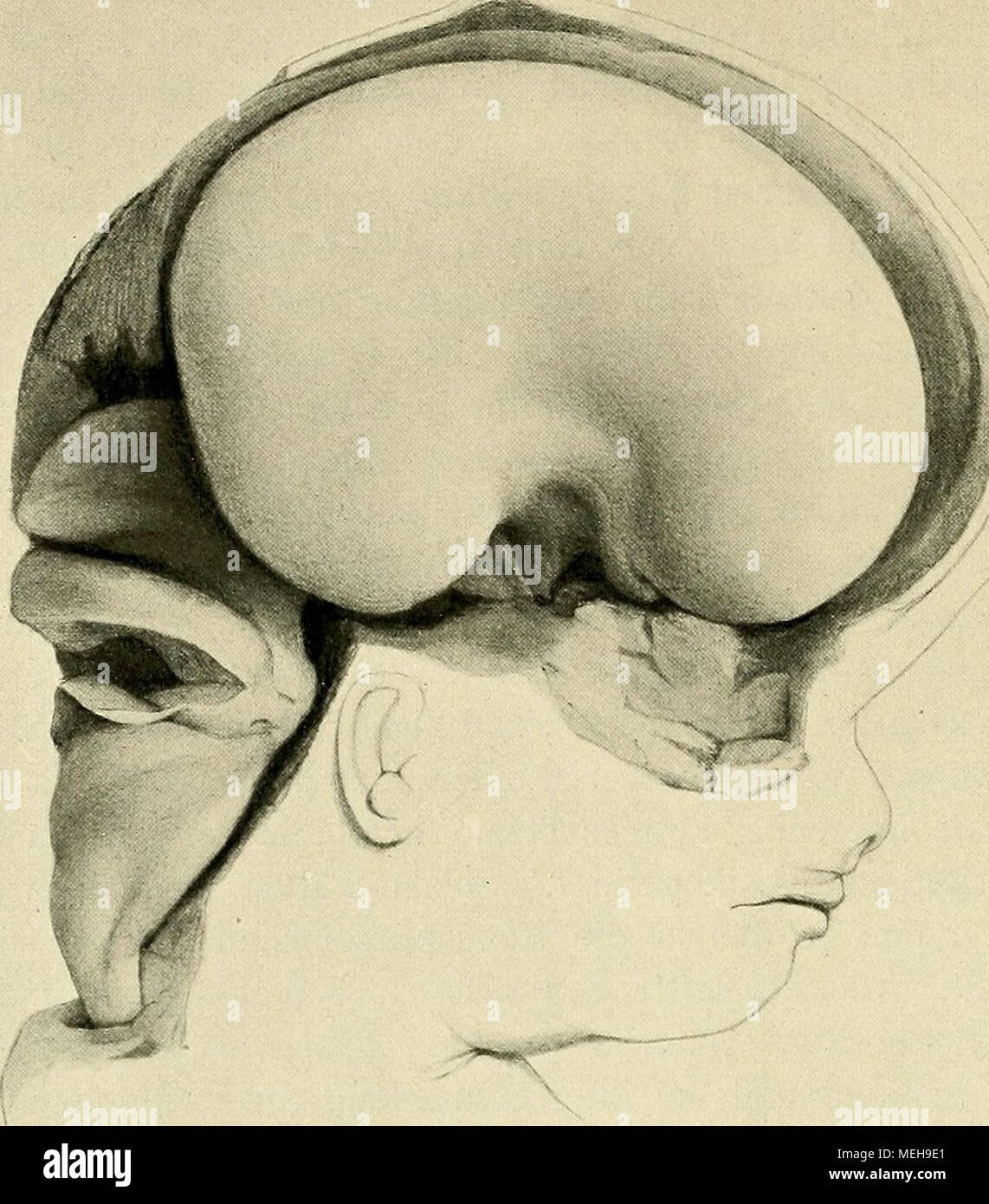 . Die Entwickelung des menschlichen Gehirns : während der ersten Monate : Untersuchungsergebnisse . t Fig. 46. Seitenansicht vom Gehirn des Foetiis von Bi 5.3 cm SSI. Glatte Hemisphäreufläche laterale. Das hintere Eieehhirn, hez. der godronné olfactorius lateralis von G. Eetzius seichte Furche erscheint durch eine vom überliegenden Gebiete der Fossa Sylvii abgesetzt. Gebrachten reproduziert Handel Modellreihe, von dem Gehirn des anderen habe ich damals eine genaue Beschreibung aufgenommen und sechs Zeich- nungen anfertigen lassen, die ich in den Figg. 46, 48, 53, 54, 62 u. Dieses 63 Aufsatzes mit Banque D'Images