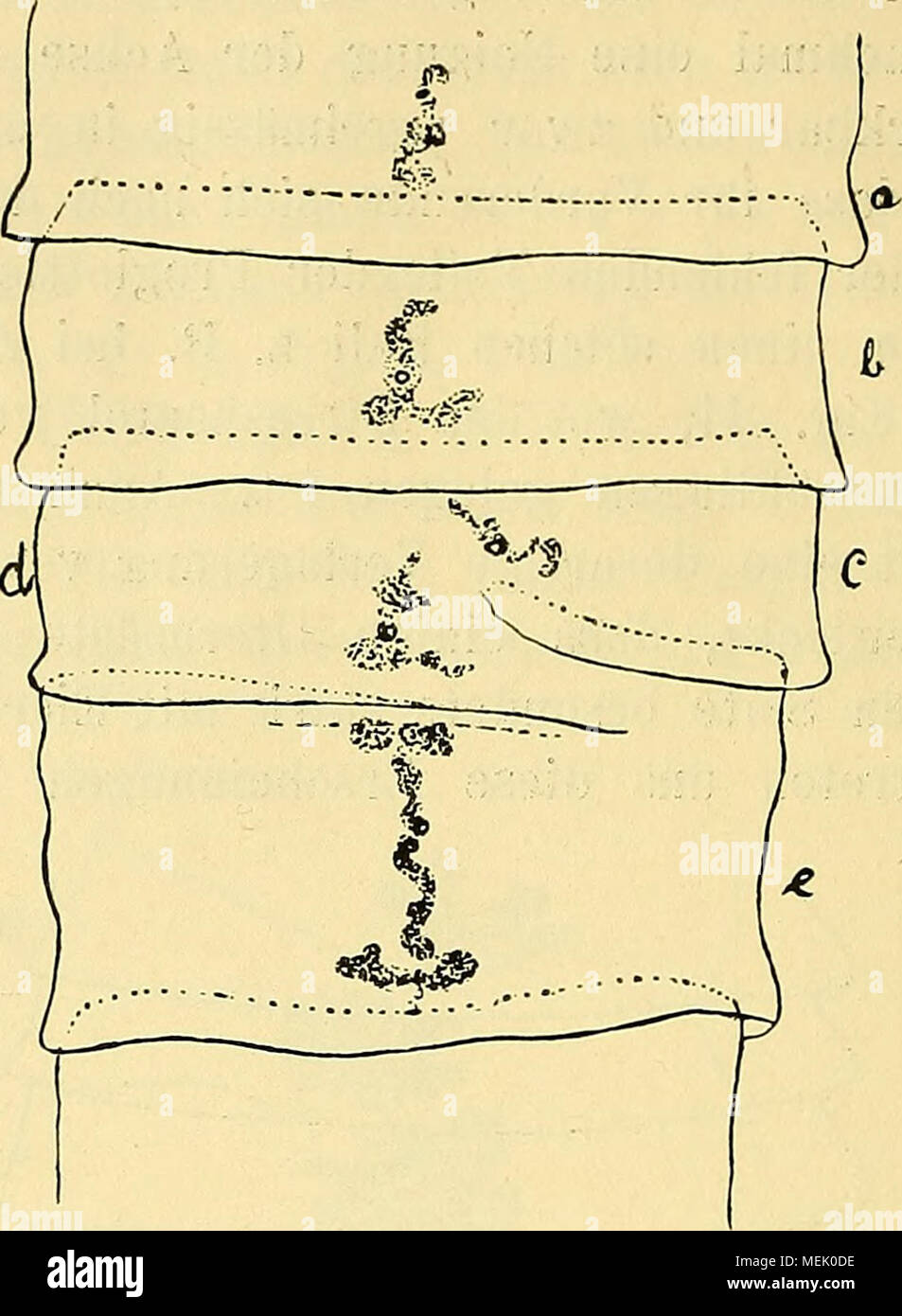 . Dans Abnormitäten Proglottiden Die den der Cestoden Bothriocephaliden, insbesondere der . Fig. 26. Proglottiswülste ausgeht dung der, der Fall sein, sondern auch in den tieferen, wo das für die Bildungsmaterial Geschlechtsorgane gelegen. Auch diese werden, wenn sie zur Ausbildung gelangen, Banque D'Images