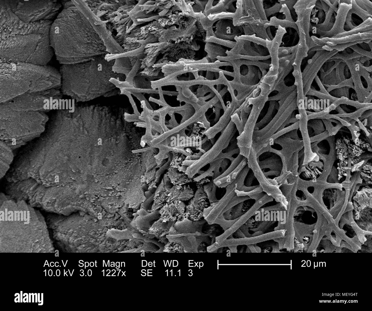 Les caractéristiques morphologiques de la surface intérieure d'une coquille d'oiseaux non identifiés, représentés dans le 1227x amplifiés en microscopie électronique à balayage (MEB) de droit, 2005. Image courtoisie Centres for Disease Control (CDC) / Janice Haney Carr, Sandra L. Westmoreland, l'Université du Texas à Arlington. () Banque D'Images