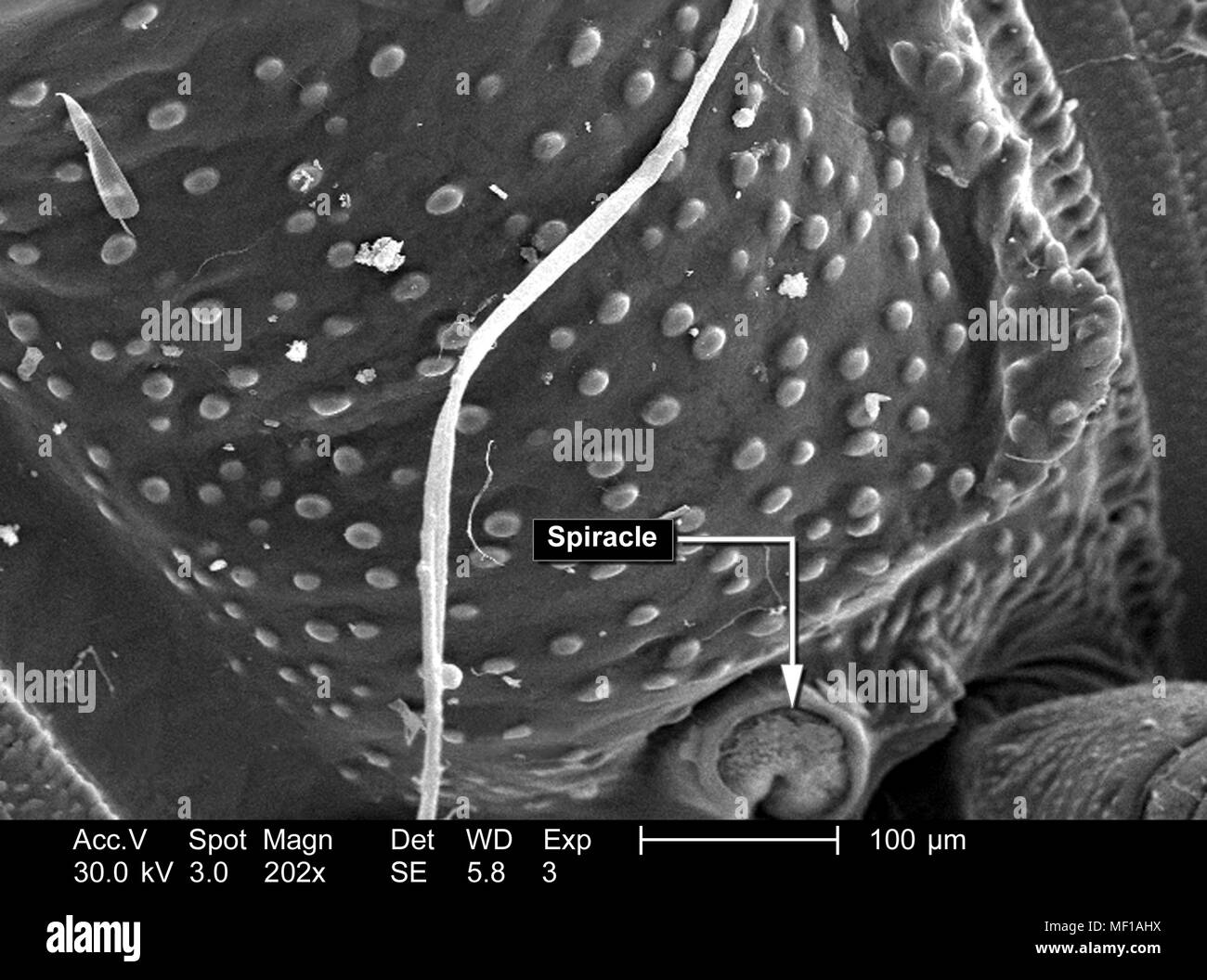 Les variations d'un modèle de corps non identifiés de l'exosquelette millipèdes, représentés dans le 202x au microscope électronique à balayage grossie (SEM) de droit, 2005. Image courtoisie Centres for Disease Control (CDC) / Janice Haney Carr, Oren Mayer. () Banque D'Images Les variations d'un modèle de corps non identifiés de l'exosquelette millipèdes, représentés dans le 202x au microscope électronique à balayage grossie (SEM) de droit, 2005. Image courtoisie Centres for Disease Control (CDC) / Janice Haney Carr, Oren Mayer. () Banque D'Images