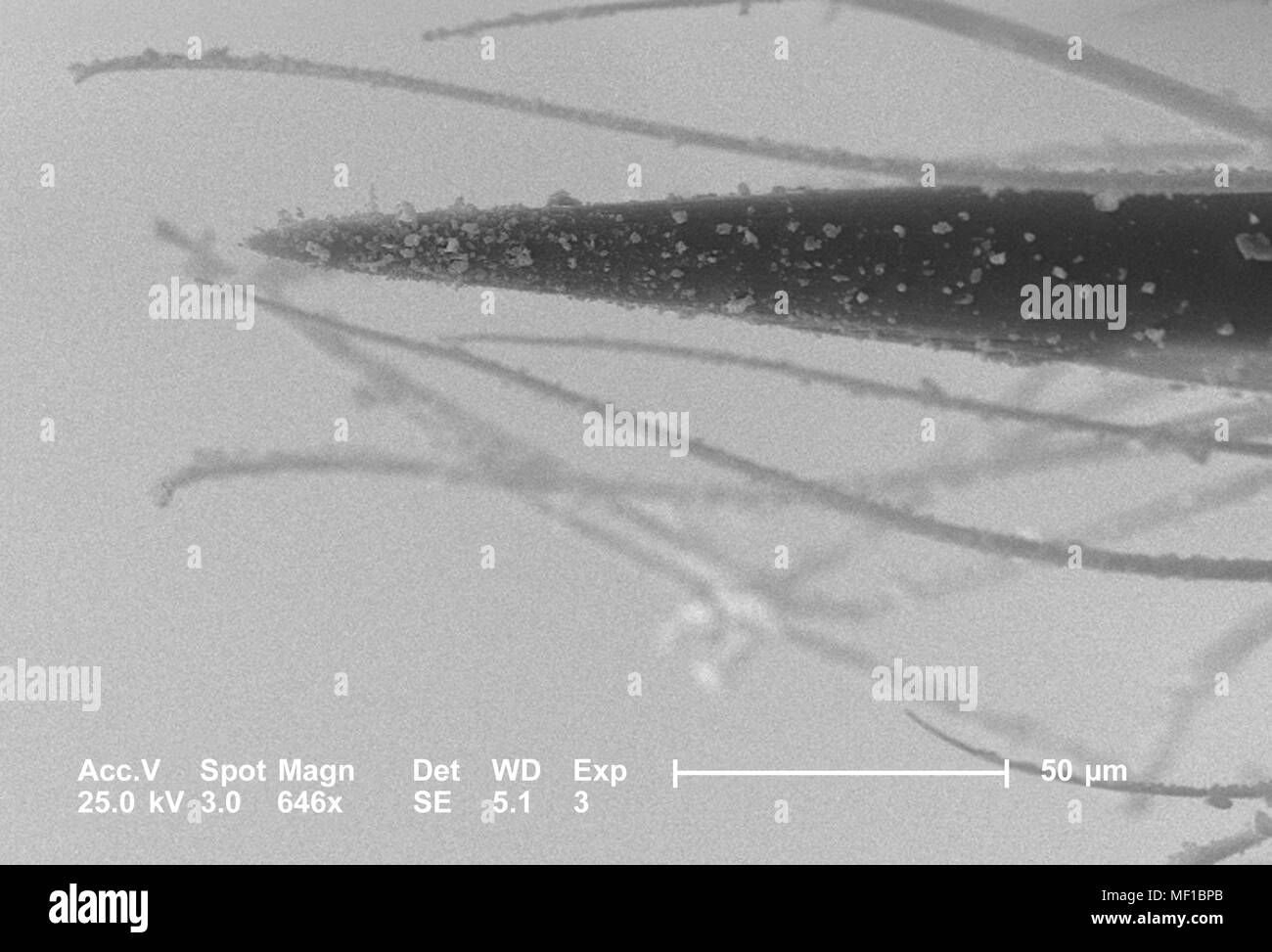 Détails morphologiques ultrastructurales d'un insecte hyménoptère non identifié appareil stinger, représentés dans le 646x au microscope électronique à balayage grossie (SEM) de droit, 2005. Image courtoisie Centres for Disease Control (CDC) / Janice Haney Carr, Oren Mayer. () Banque D'Images