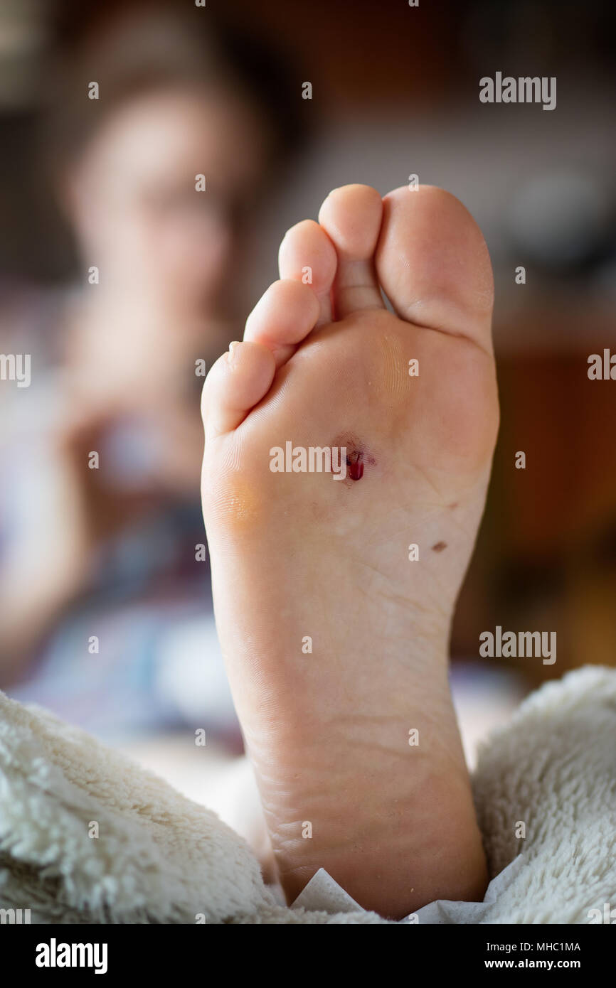 Blessé au pied féminin. Une blessure de l'ongle que percé la chaussure.  Fond clair Photo Stock - Alamy